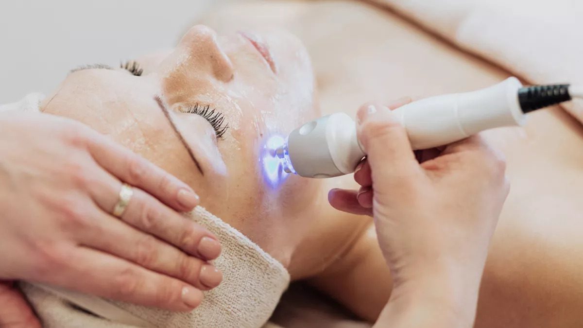 Terapi Laser untuk Flek Hitam di Wajah, Efektifkah?