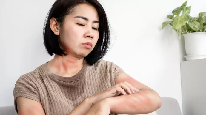 Alergi Kulit: Kenali Jenis, Penyebab, dan Cara Mengatasinya