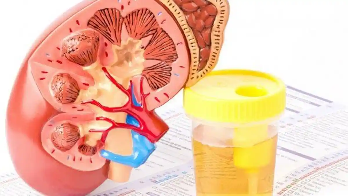 7 Minuman yang Diam-Diam Bisa Memberatkan Ginjal